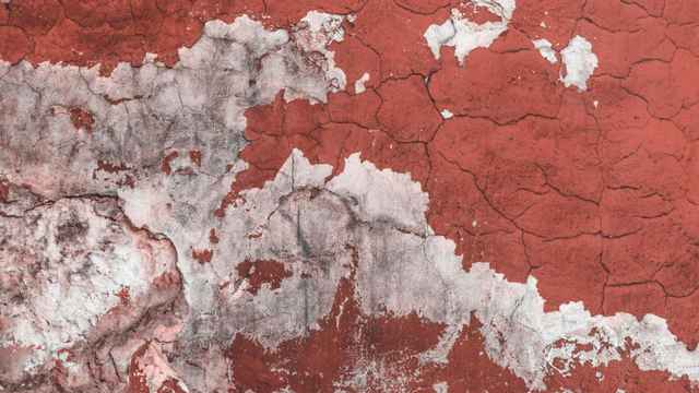 Oberschenkelbeinbruch